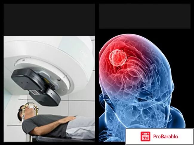Можно ли победить рак. Апитерапия при онкологии головного мозга. Влияет ли смартфон на опухоли головного мозга. Тату после онкологии головного мозга. Фото мозга водителя и инженера.