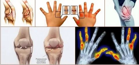 Покемоннан офицер Дженнимен порно