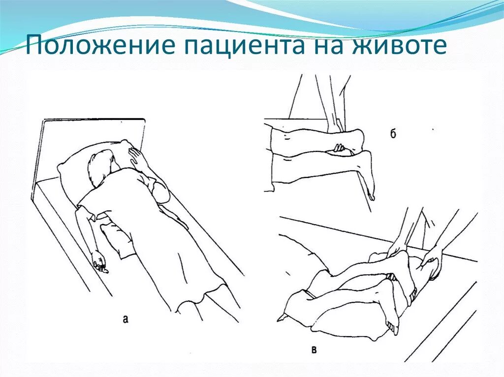 Положение пациента лежа на животе. Перемещение пациента лёжа на животе. Размещение пациента на животе. Укладывание пациента на живот.