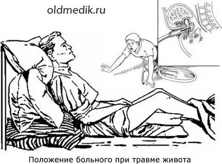 После ушиба живота