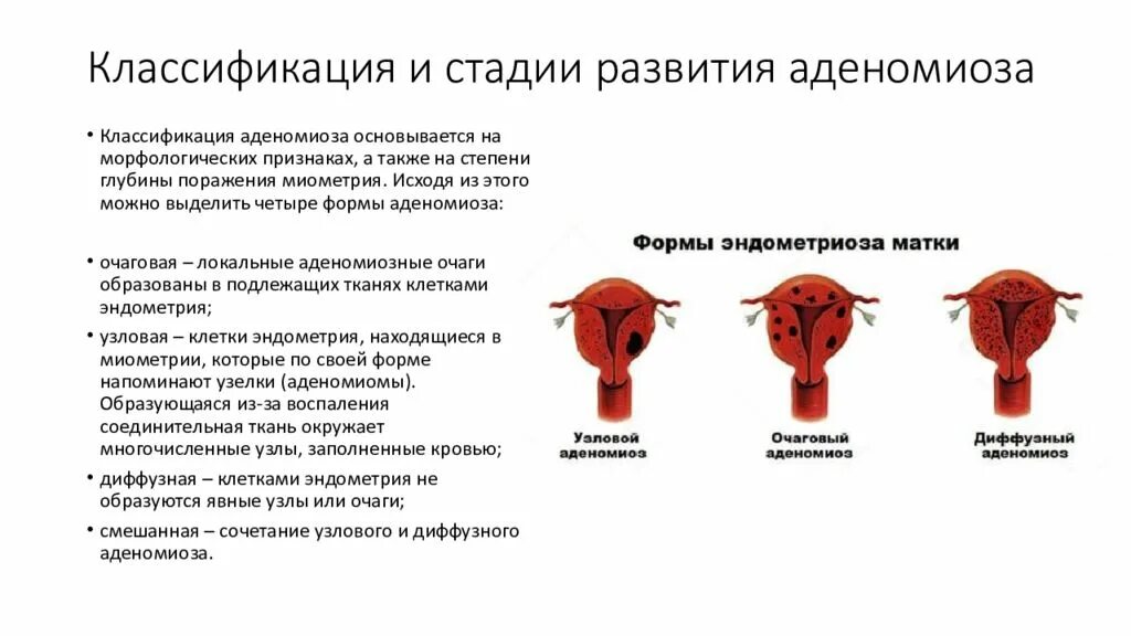 Диффузная матка. Диффузная матка