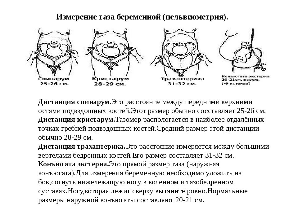 Размеры таза в акушерстве измерение. Измерение размеров таза беременной. Измерение размеров таза пельвиометрия. Измерить наружные Размеры таза алгоритм. Изм техника