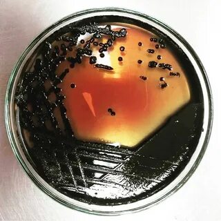 Сальмонелла при кипячении