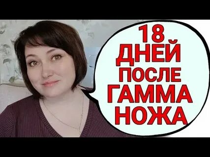 После гамма