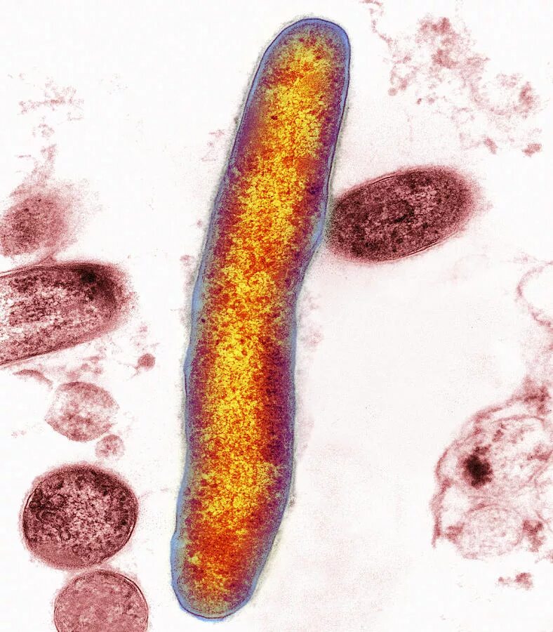 Микобактерия туберкулеза палочка Коха. Палочка Коха туберкулез. Mycobacterium tuberculosis микробиология. Палочка Коха микробиология.