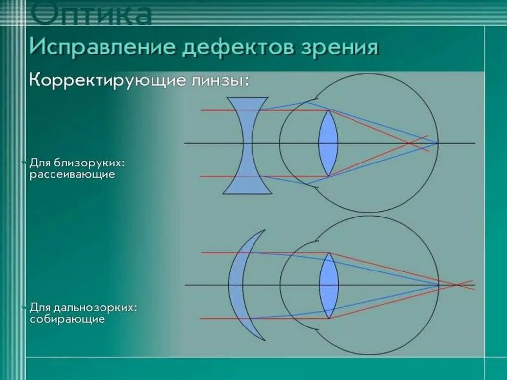 Как можно скорректировать дальнозоркость. Линзы и дефекты зрения. Дефекты зрения дальнозоркость. Выпуклые линзы для близоруких. Рассеивающая линза для близорукости.