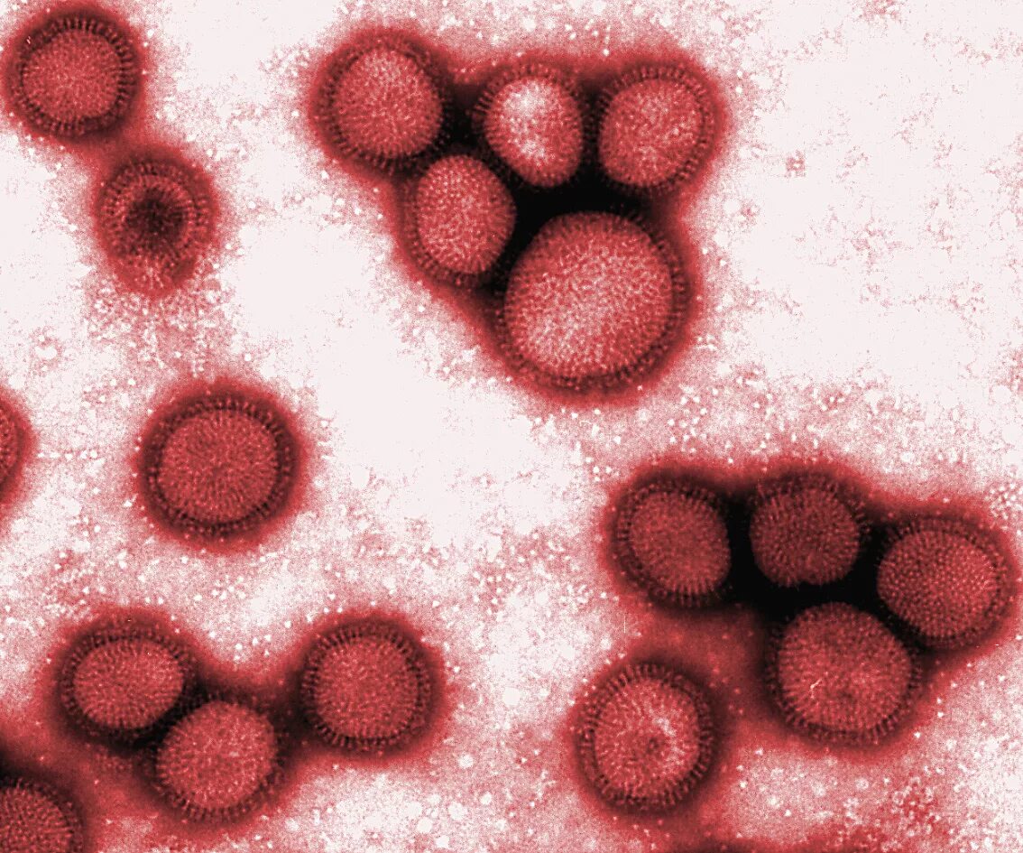 Вирус h1n1 испанка. H2n2 грипп под микроскопом. Испанка болезнь под микроскопом.