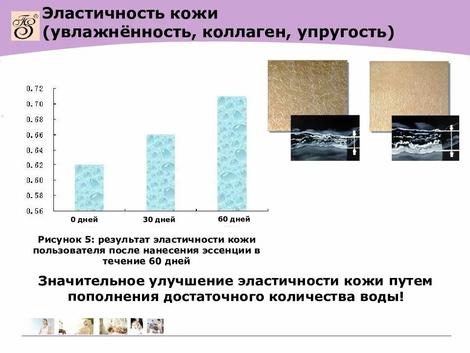 Содержание кожи. Эластичность кожи обеспечивают. нормальная эластичность кожи. увлажненность кожи норма. эластичность и упругость кожи зависят от.