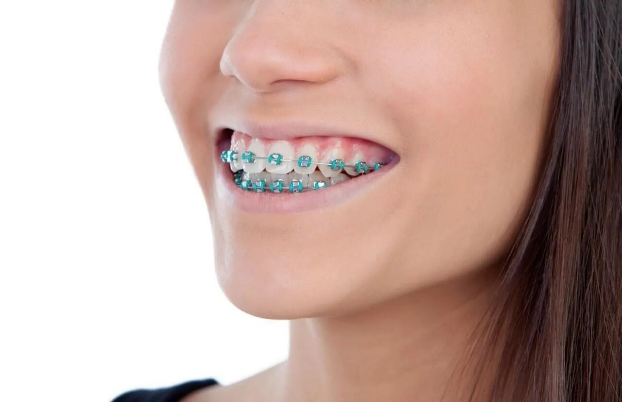 Matching brackets