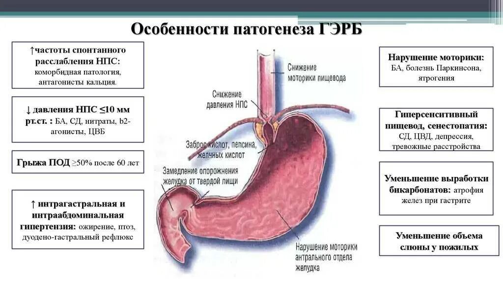 Как избавиться от гэрб. Гастроэзофагеальный рефлюкс патанатомия. газоэзофагальнаярефлюксная болезнь. гэрб у детей клинические рекомендации. гастроэзофагеальная рефлюксная болезнь симптомы.