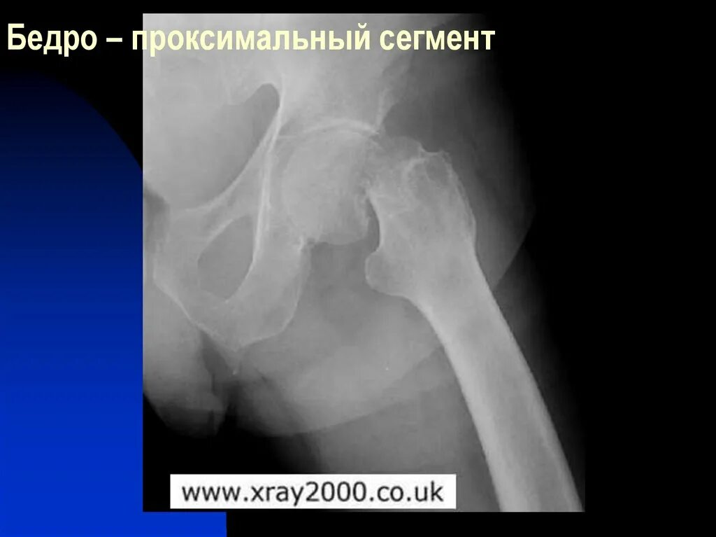 Проксимальной слабости. Дистально и проксимально это. Проксимальный сегмент. Проксимальный и дистальный. Проксимальный и дистальный движения-.