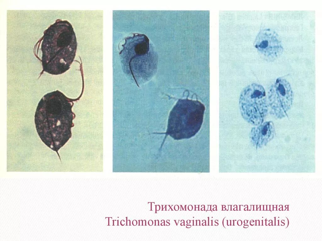 Трихомоноз у мужчин симптомы. Урогенитальная трихомонада циста. Трихомонады возбудители трихомоноза. Влагалищная трихомонада возбудитель. Ротовая трихомонада.