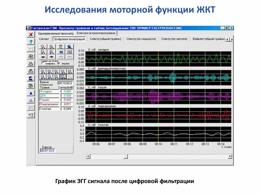 Исследование моторной функции. Исследование двигательных функций. исследование моторной функции желудка. график исследования моторных функций. таблица обследование моторных.