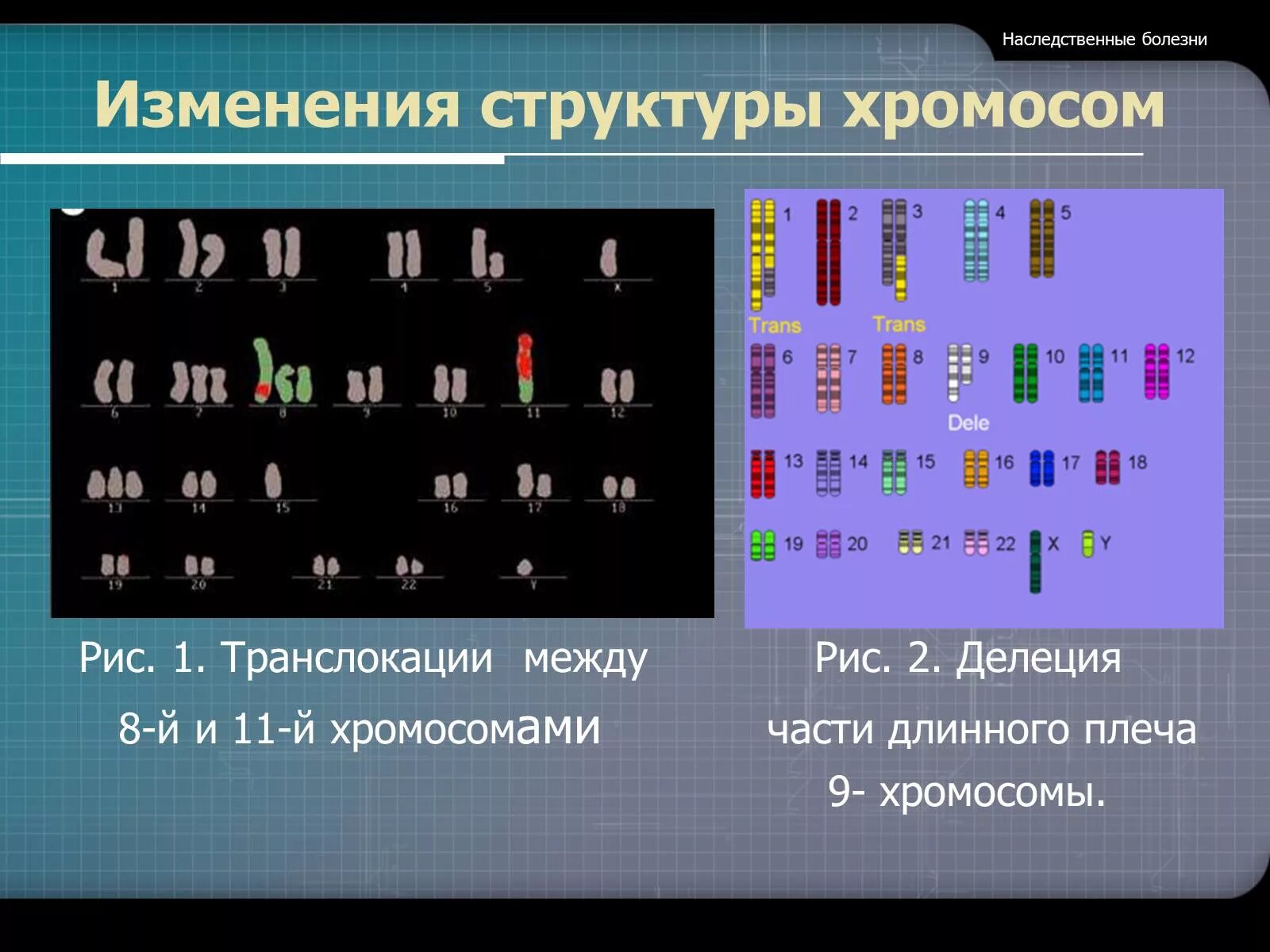 Болезни связанные с изменением хромосом. Структурные изменения хромосом. Изменение структуры хромосом. Изменение структуры хромосом болезни. Измененная структура хромосом.