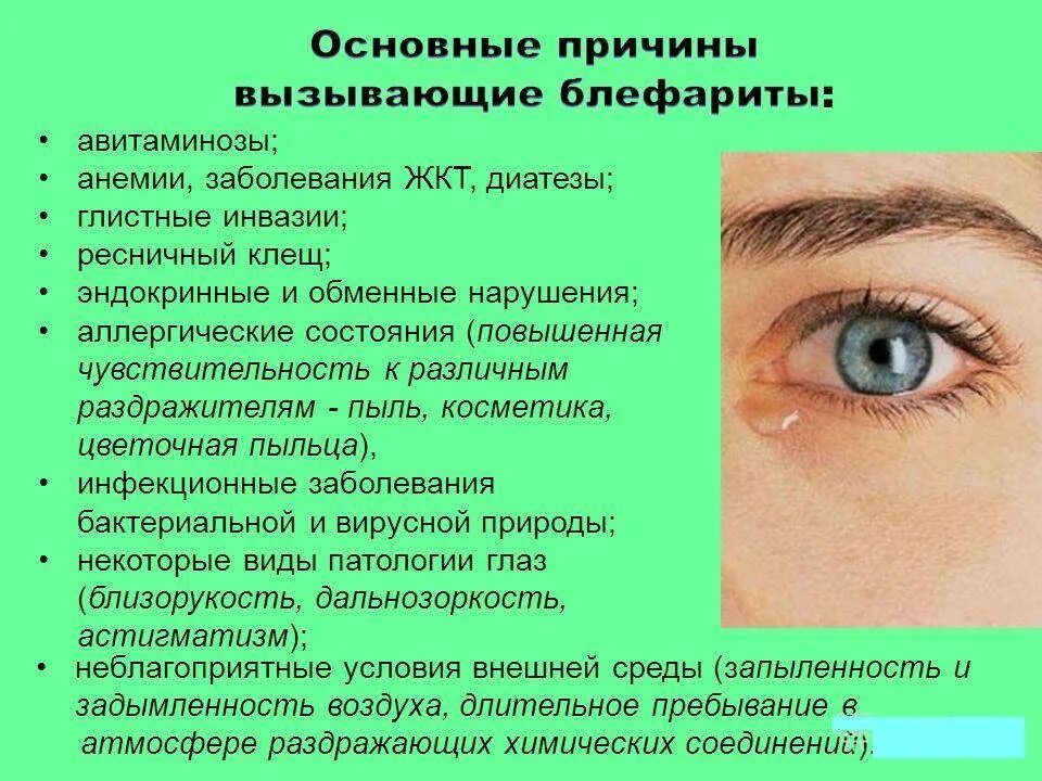Причины появления отеков. Блефарит причины возникновения. Заболевание глаз блефарит.