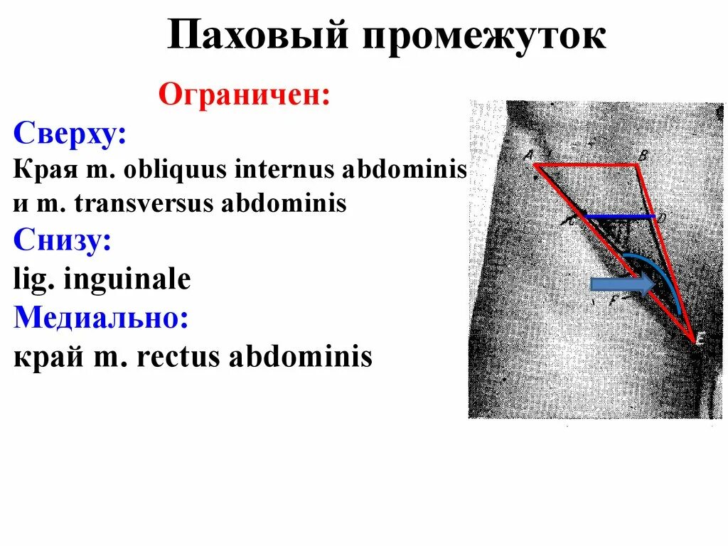 Как отличить паховую