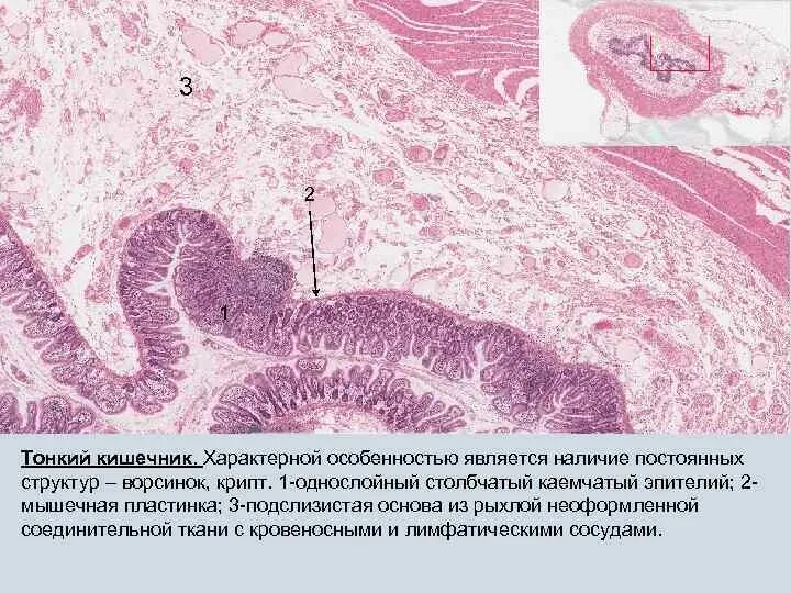Ободочная толстая кишка анатомия. Анатомические структуры толстого кишечника:. Для толстой кишки характерно наличие. Ободочная толстая кишка анатомия. Для толстой кишки характерно наличие.
