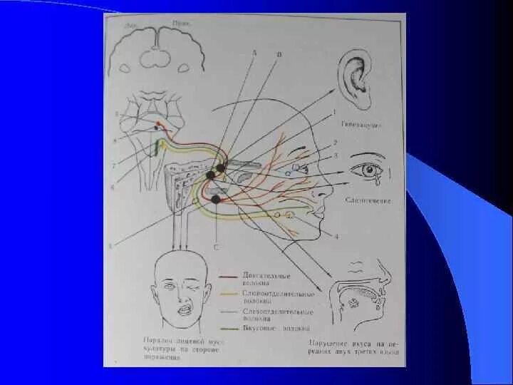 Ядра блуждающего нерва иннервация. 10 пара черепных. 10 пара черепных. Схема 10 пары черепных нервов. 10 пара блуждающий нерв схема.