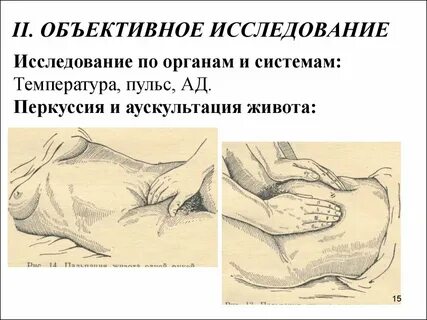 Перкуссия живота