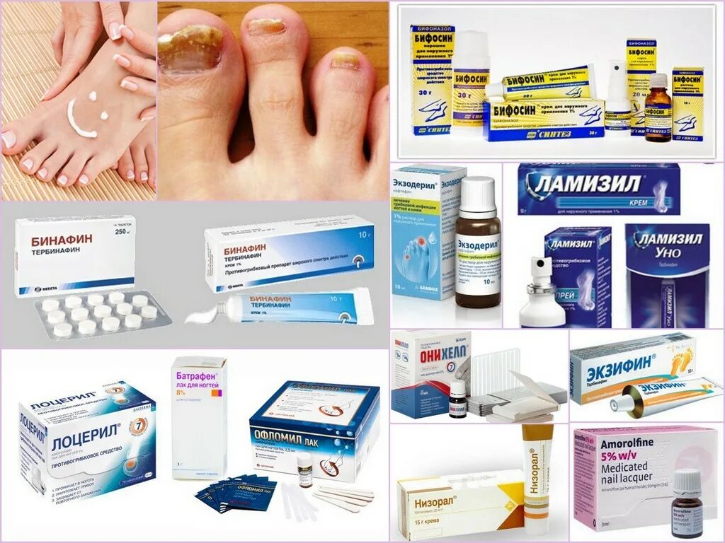 Соберите информацию о грибковых заболеваниях. Лекарство против грибка ногтей на ногах. Лекарство мазь от грибка ног. Лекарство против грибка на ногтях. Средство от грибка ногтей эффективное и недорогое.