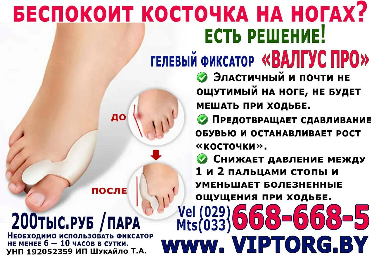 От шишек на ногах у большого пальца. Средство от артритных шишек на ногах. Лечение шишки на ноге народными средствами. Лекарство от косточек на ногах. Гелевый фиксатор valgus pro.