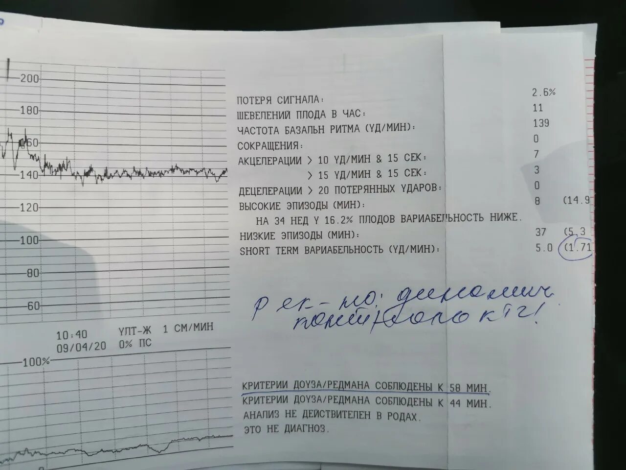 КТГ ПСП 34 недель норма таблица. КТГ при беременности показатели вариабельность. Норма КТГ В 34 недели. Вариабельность на КТГ 5,1. Шевеление плода 32 неделя