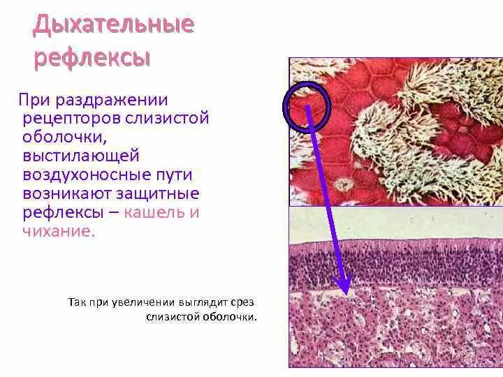 Защитные рефлексы дыхания. Защитные дыхательные рефлексы. Защитные дыхательные рефлексы физиология. Защитные дыхательные рефлексы возникают при раздражении:. Защитные рефлексы слизистой носа.