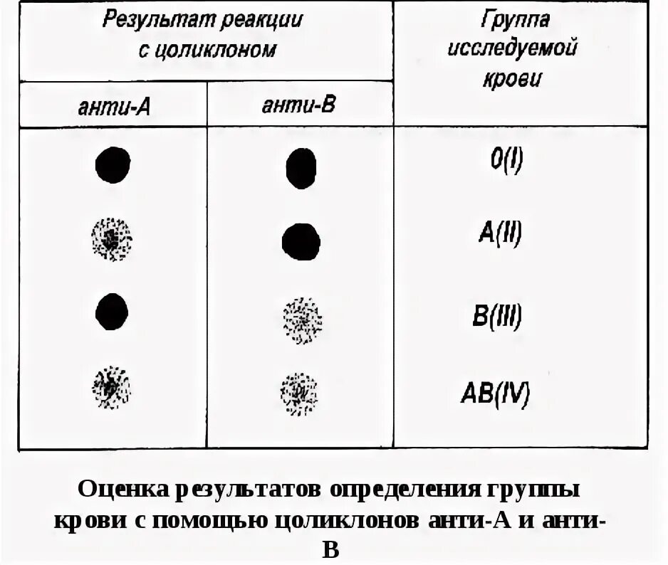 Цоликлоны для определения группы крови и резус фактора. Определение резус фактора крови цоликлонами. Методика определения группы крови цоликлонами. Определение группы крови цоликлонами алгоритм. Группа крови по цоликлонам