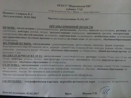 Перегиб желчного отзывы
