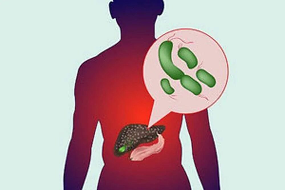 Бактерии печени