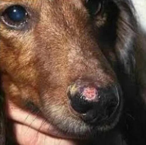 Клинический случай. Системная красная волчанка (systemic lupus erythematosus) у 