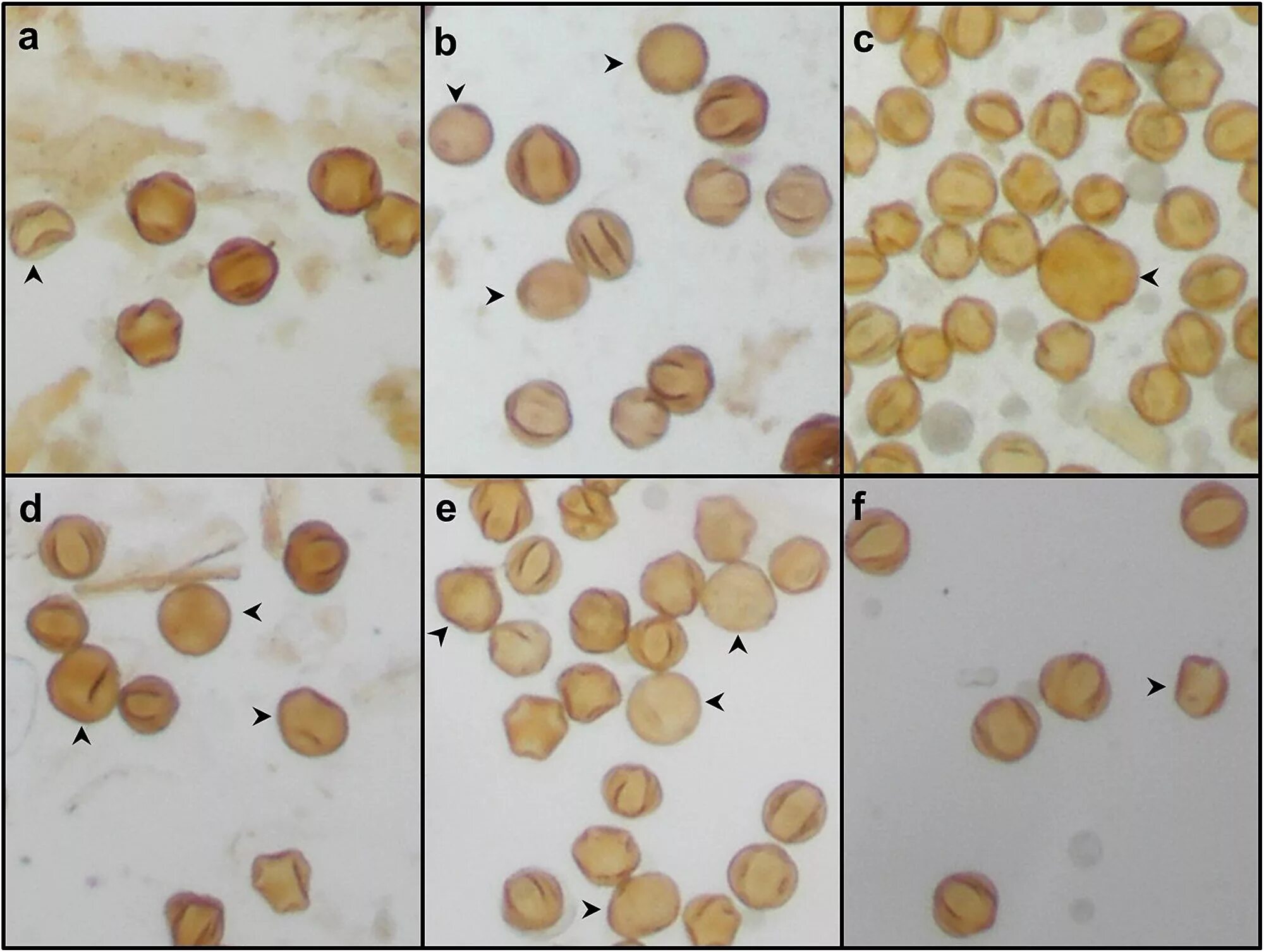 Пыльца число. Пыльца сосны микроскопия. Пыльца нарцисса микроскопия. Пыльца в микроскопе. Пыльца в Кале.