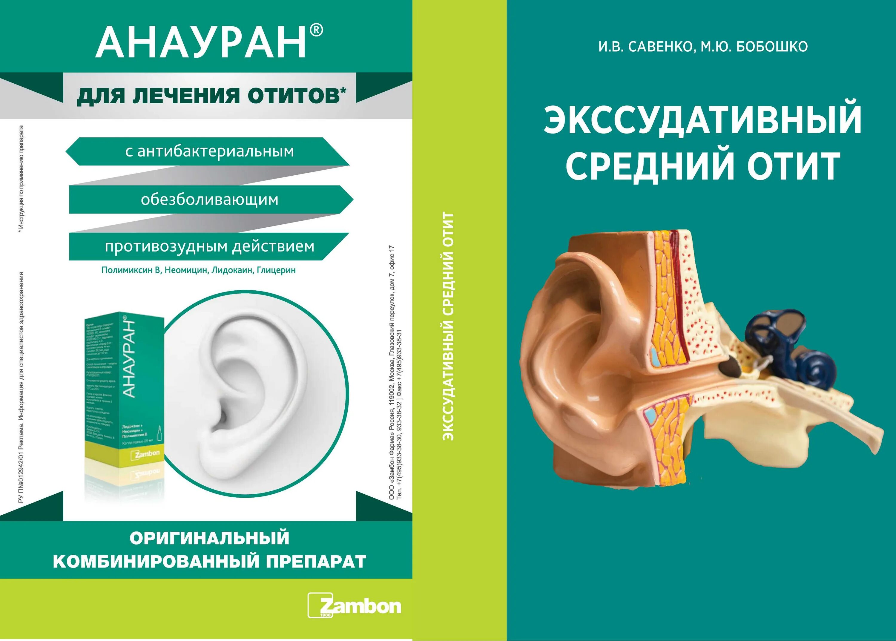 Как лечить средний отит. Экссудативный острый средний отит диагностика. экссудативный средний отит лечение препараты. экссудативный средний отит у детей. экссудативный отит среднего уха.