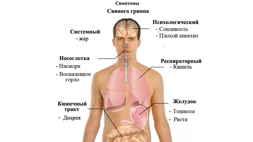 Грипп ковид 2024. Симптомы гриппа. Свиной грипп. Симптомы гриппа свиной грипп. Клиническая картина ОРВИ.