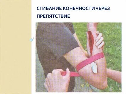 Артериальное кровотечение конечности
