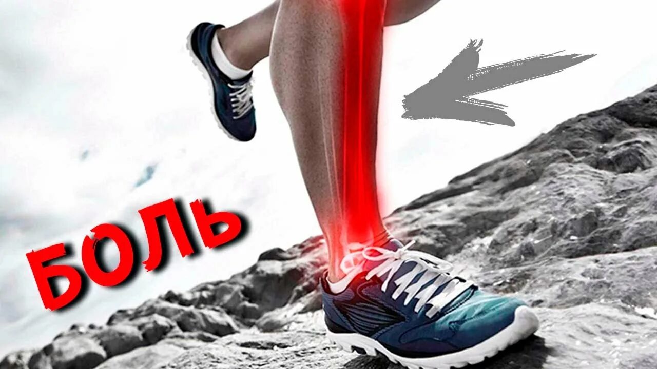 болит нога ниже колена спереди при ходьбе. болит нога ниже колена спереди при ходьбе. боль берцовой кости в ноге спереди. кость на ноге спереди от колена до стопы. болит надкостница голени.