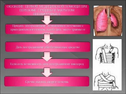 И грудной клетки при помощи