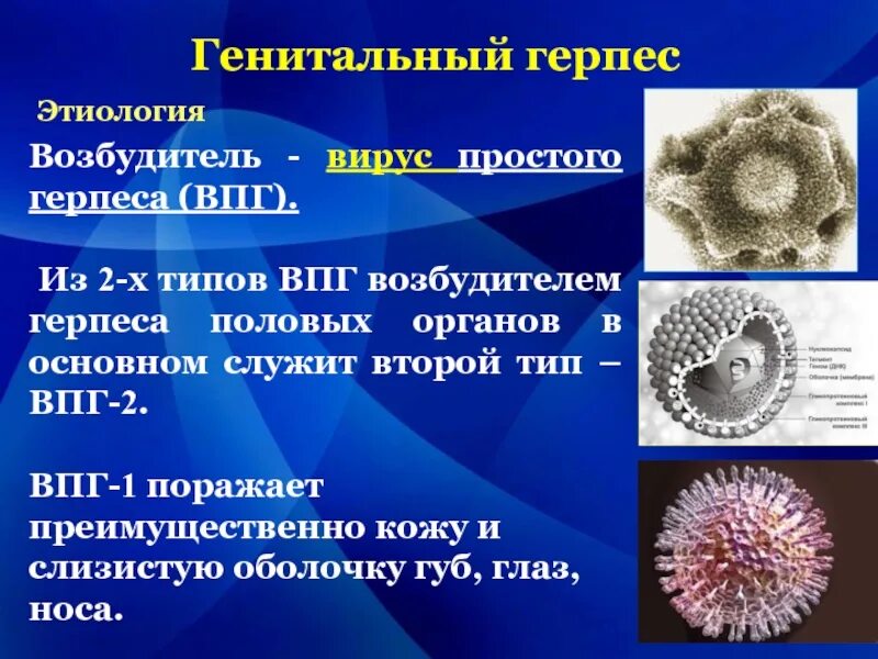 Вирус простого герпеса 1 и 2 типа. Этиология вируса простого герпеса 2 типа. вирус герпеса 1 типа этиология. генитальный герпес возбудитель инфекции. вирус простого герпеса 1 типа этиология.