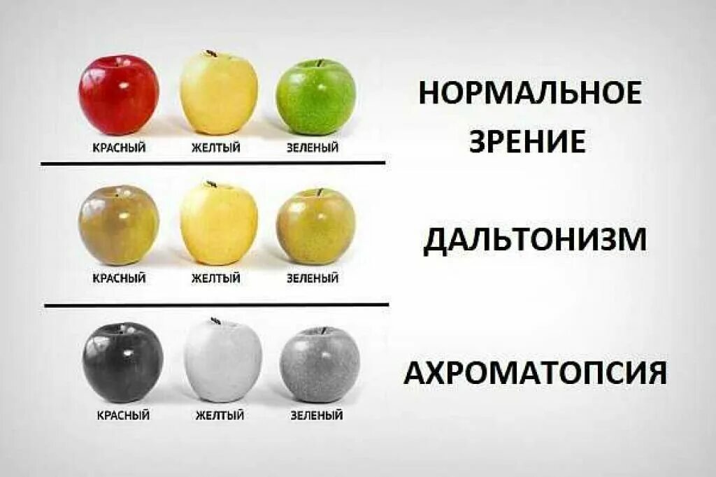 Полная цветовая слепота. Полная цветовая слепота — ахромазия. Дальтонизм ахроматопсия. Дальтонизм и нормальное зрение.