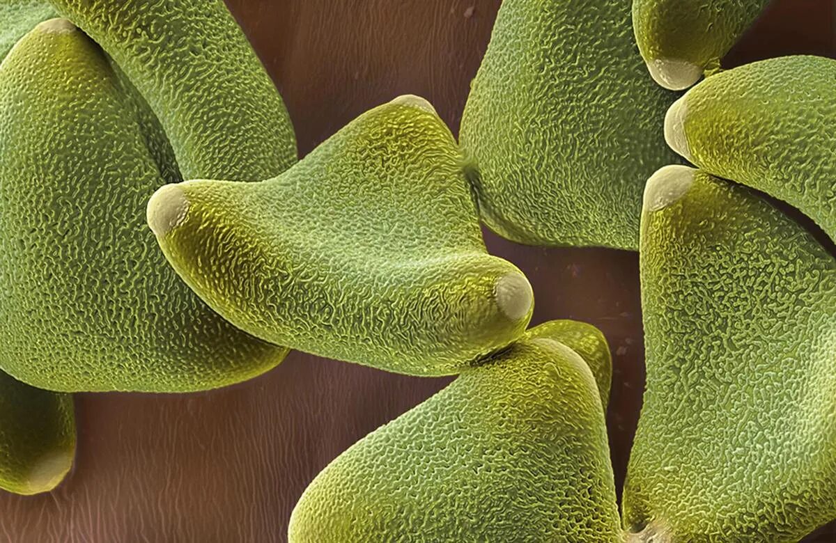Пыльца дуба под микроскопом. Пыльца растений под микроскопом. Пыльца в микроскопе. Пыльца цветковых растений под микроскопом. Воздушная пыльца