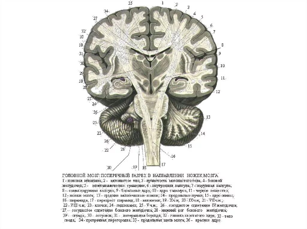 Срез головного мозга. Головной мозг поперечный разрез. строение головного мозга в поперечном разрезе. поперечный срез головного мозга анатомия. поперечный срез головного мозга схема.
