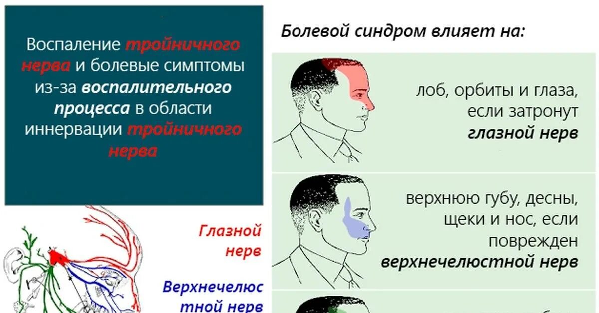 Пульс на лбу. Признаки невралгии тройничного нерва. Воспаление тройничного лицевого нерва симптомы. При невралгии тройничного нерва наблюдается симптомы. Признаки поражения тройничного нерва неврология.