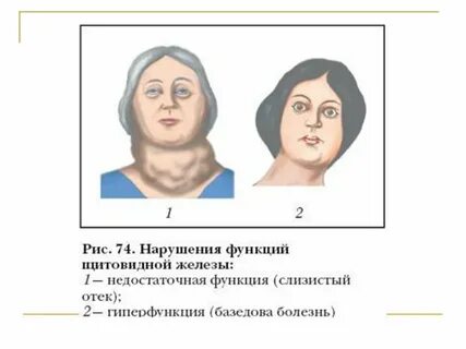 Слизистый отек симптомы