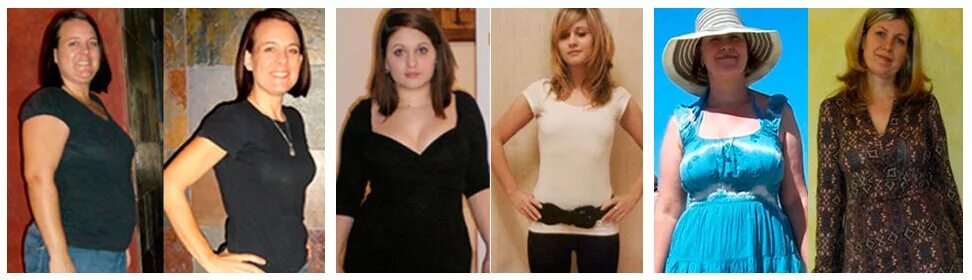 гипотиреоз фигура женщины. советы эндокринолога. похудел при гипотиреозе форум. внешность людей с гипотиреозом. похудел при гипотиреозе форум.