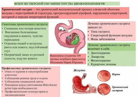 Симптом хронического гастрита с сохраненной секрецией