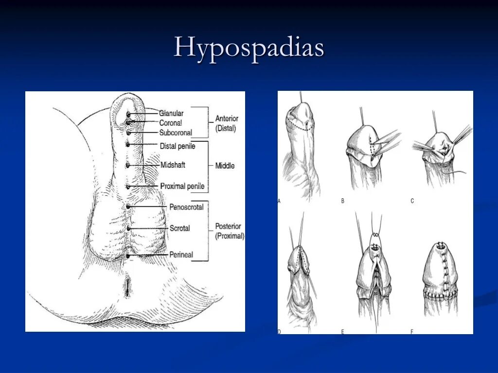 Венечная борозда у мужчин. Строение сердца человека сзади. Венечная борозда сердца (sulcus coronarius):. Венечная борозда сердца анатомия. Венечная борозда у мужчин.