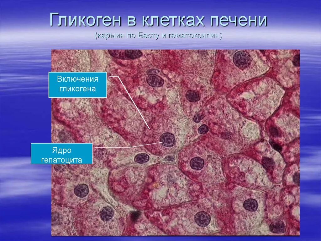 В клетках печени происходит. Включения гликогена гистология. Включения гликогена препарат гистология. Гликоген препарат гистология. Включения гликогена в печени аксолотля.