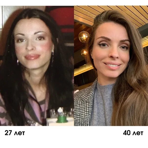 Бурдюг разоблачение до и после пластики Неактивно
