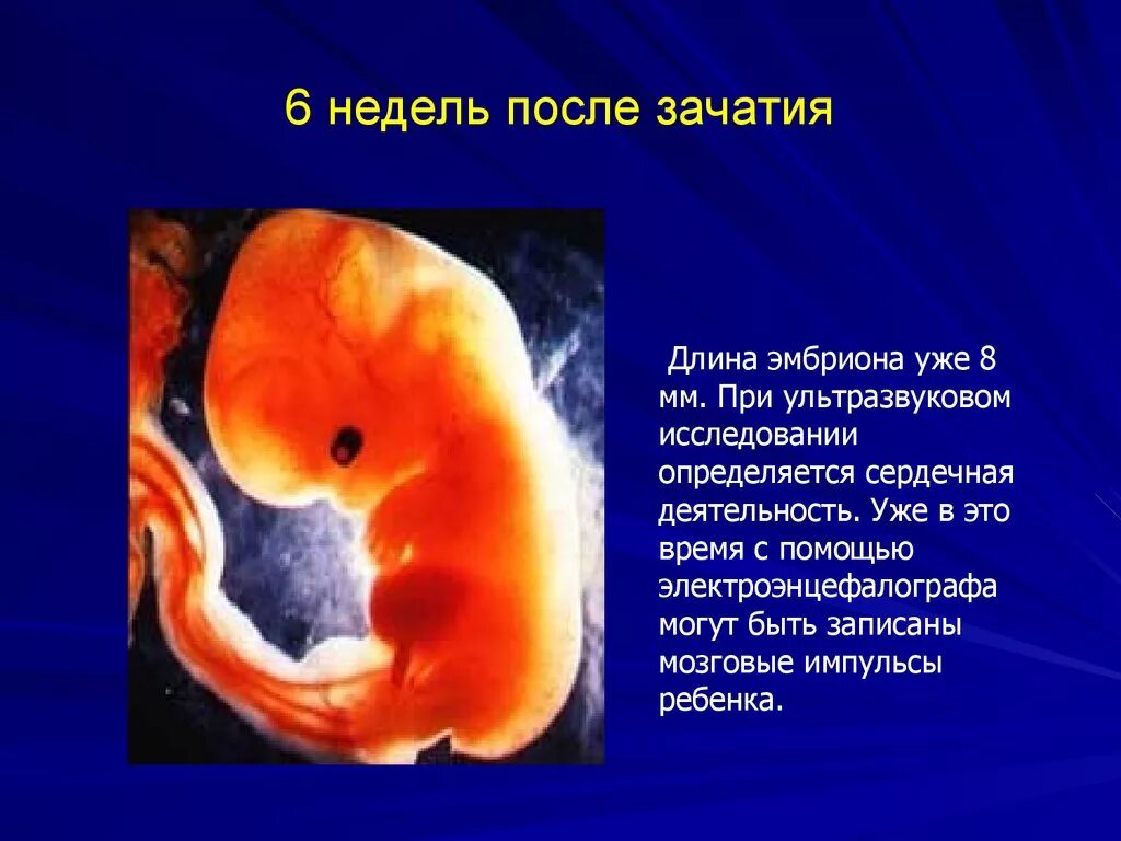 Про 6 неделю. Размер эмбриона в 6 недель акушерских. Плод 5-6 недели беременности размер плода. Эмбрион 5-6 недели беременности в животе. Плод на 5 недель 6 дней беременности эмбрион.