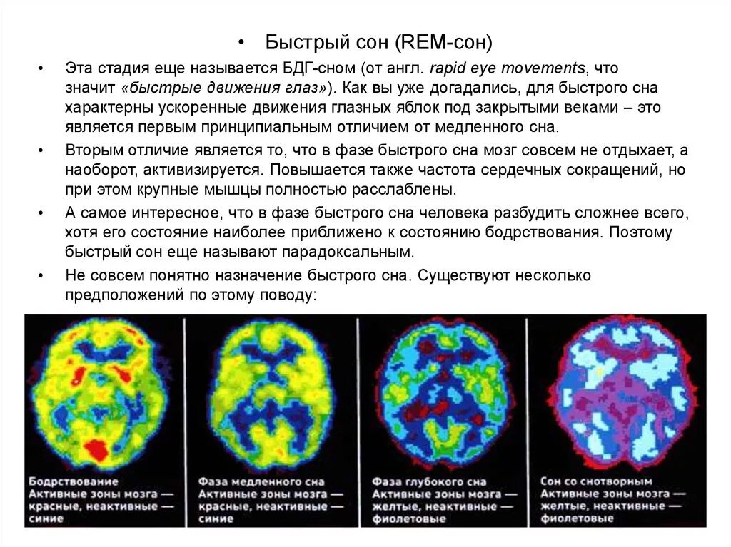 Rem быстрый сон. Rem стадия сна.